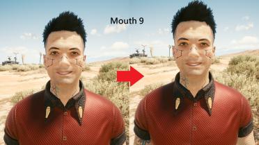 Male V teeth restoration