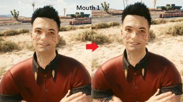 Male V teeth restoration