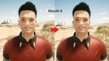 Male V teeth restoration