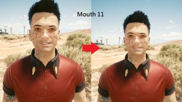 Male V teeth restoration