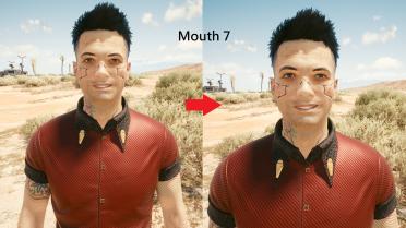 Male V teeth restoration