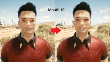 Male V teeth restoration