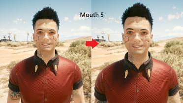 Male V teeth restoration